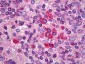BCL2 / Bcl-2 Antibody